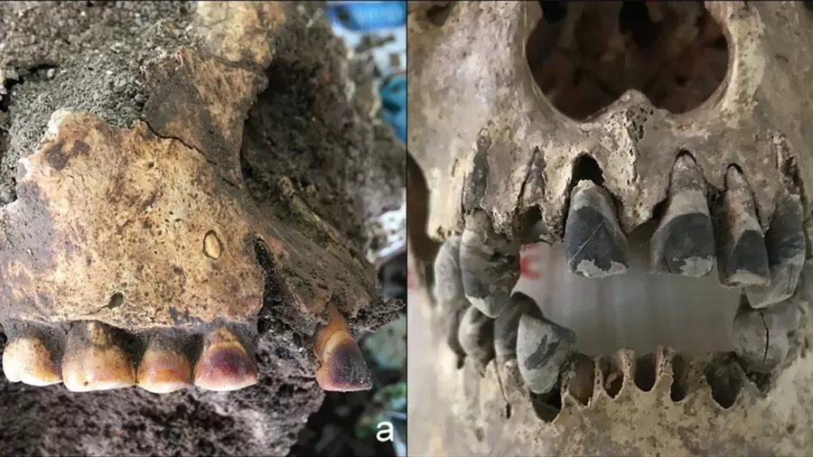 cranio de 2000 anos com dentes pintados de preto sao encontrados em dong xa no vietna 1772723116105 v2 900x506.png